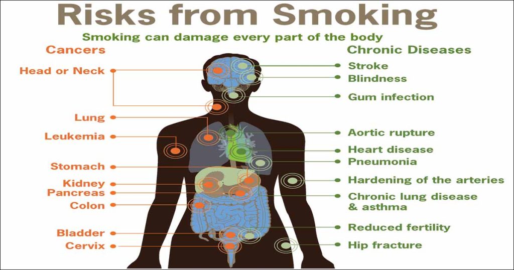 Smoking Problems